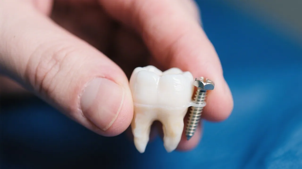 Understanding Dental Implant Costs Nearby